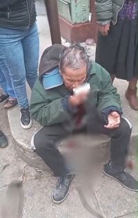 Adulto mayor es agredido en v&iacute;a p&uacute;blica 