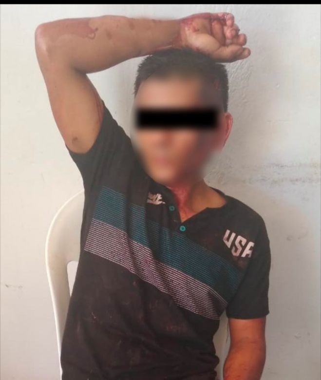 DETIENE SSYPC A PRESUNTO RESPONSABLE DE HOMICIDIO EN ESCUINTLA