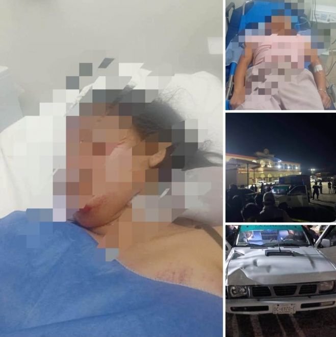 Atropellan a una señora y a una jovencita en el Arco de Oxchuc