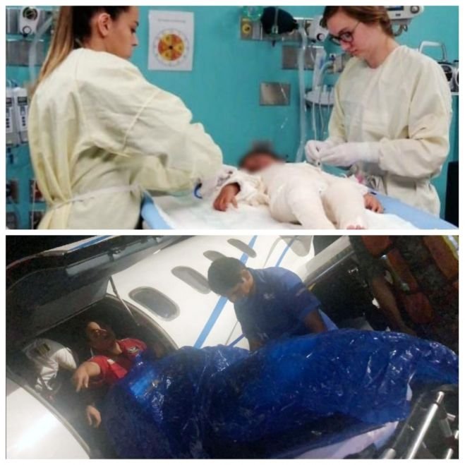 Gobierno del Estado, a trav&eacute;s del DIF Chiapas, traslada a ni&ntilde;a con quemaduras a EUA para atenci&oacute;n m&eacute;dica