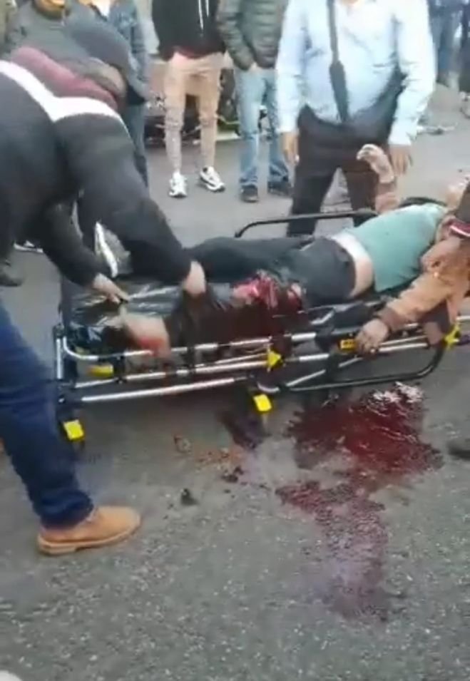 Motociclista gravemente lesionado en accidente