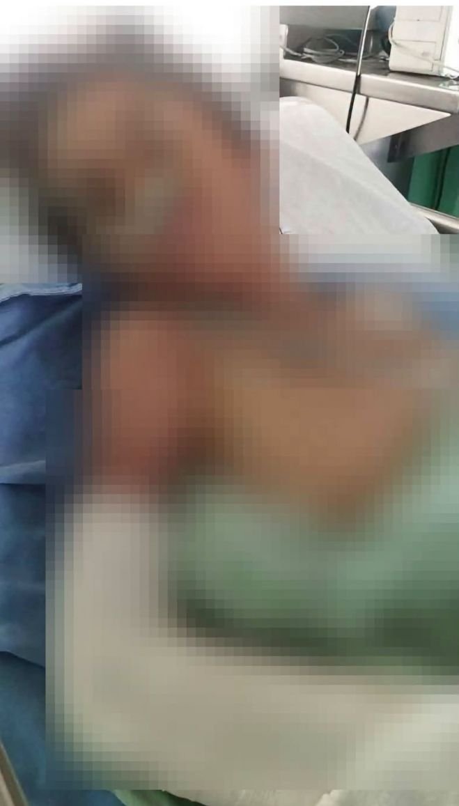 Alumno resulta lesionado en escuela; lleva 13 días hospitalizado