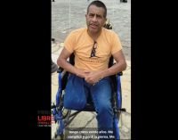 &quot;Perdí mi pierna por la diabetes”: paciente pide apoyo en San Cristóbal de Las Casas