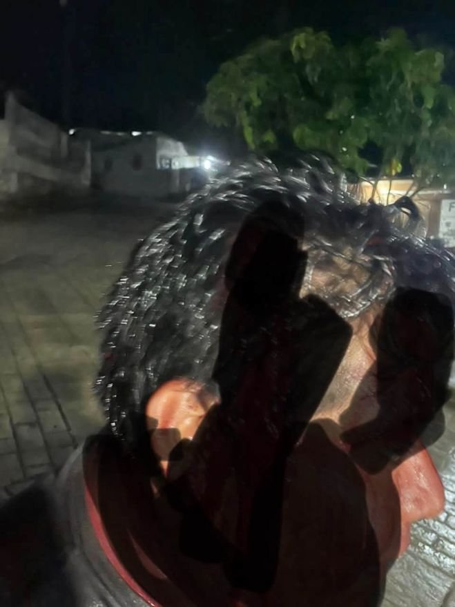 Balean a hombre en Chenalh&oacute;