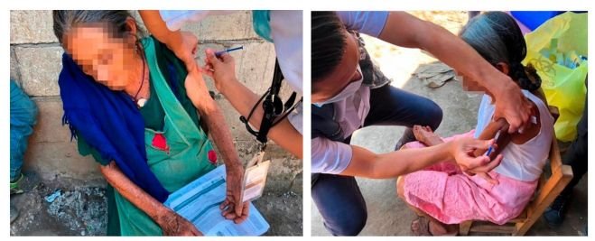 Este martes continúa aplicación de segunda dosis en Tuxtla Gutiérrez y región Soconusco