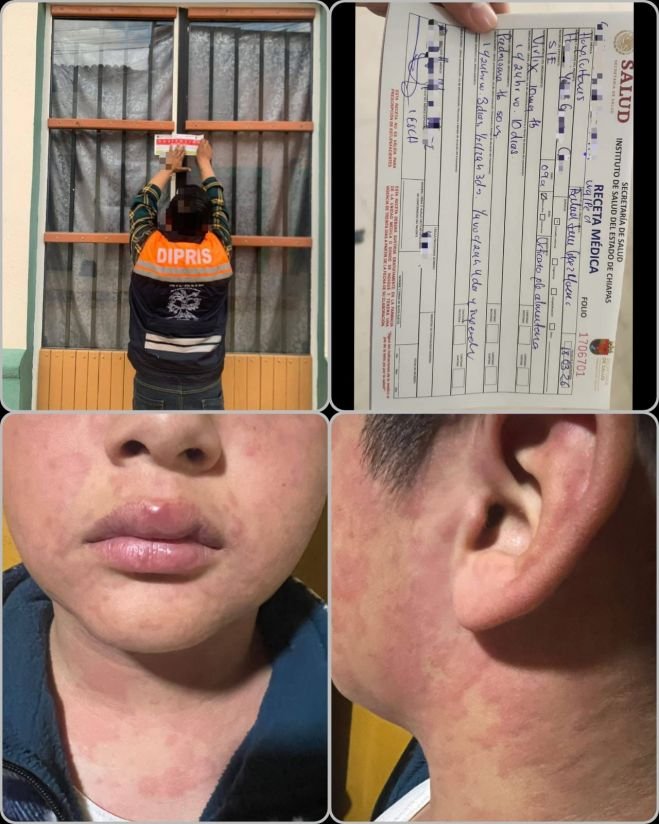 Suspenden restaurante “Casa Salmos” tras verificación sanitaria