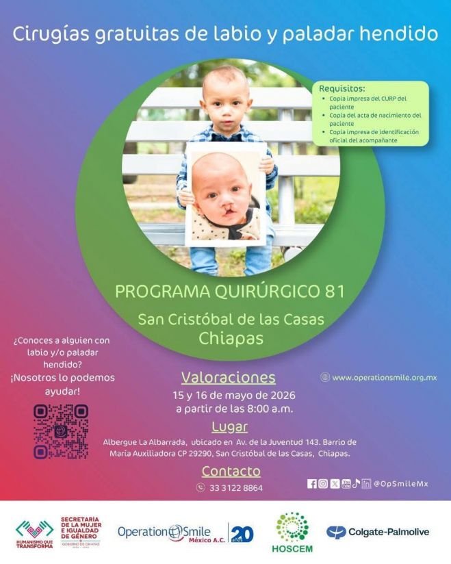 Anuncian cirugías gratuitas de labio y paladar hendido en San Cristóbal de Las Casas