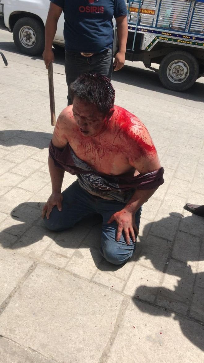 Grupo Interinstitucional logra rescate de una persona tras ri&ntilde;a en zona sur de SCLC